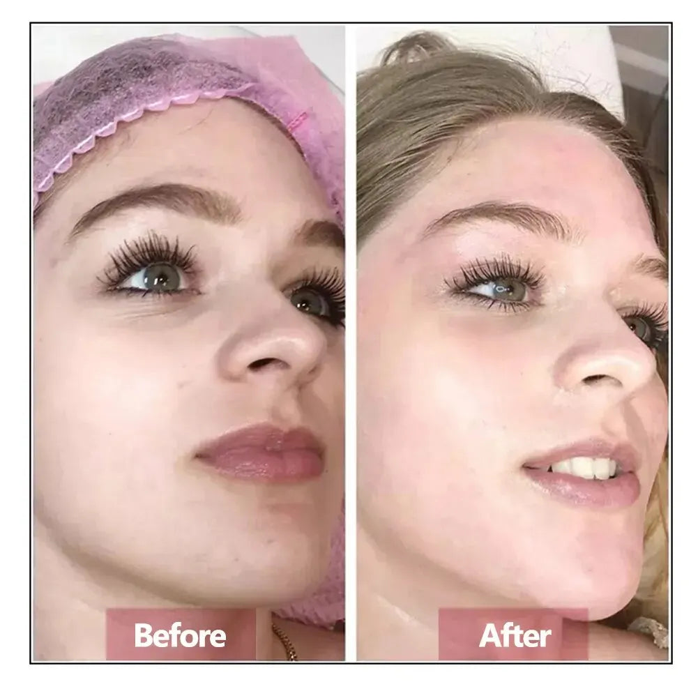 Hyaluronic Acid Face Serum