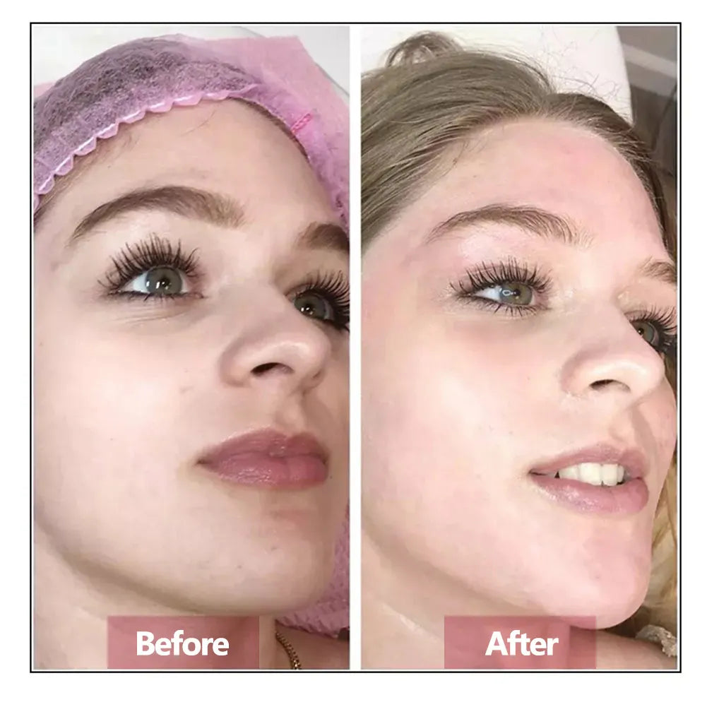 Hyaluronic Acid Face Serum